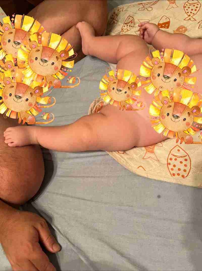 だいたひかるさん　手に浮腫みの症状で手術へ「ゴム手袋に　空気を含ませたような手に」