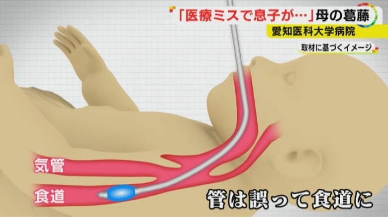 生後7カ月の我が子が突然意識不明に…「医療ミスが原因」 時効迫り提訴した母の苦悩【愛知発】