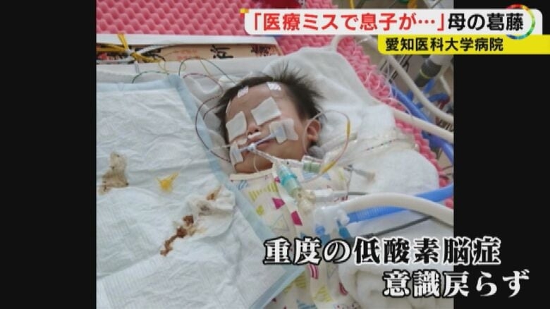 生後7カ月の我が子が突然意識不明に…「医療ミスが原因」 時効迫り提訴した母の苦悩【愛知発】
