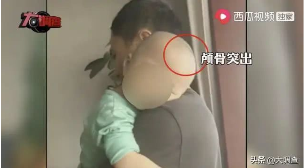 中国で偽粉ミルクが続出　飲んだ乳幼児の頭が大きくなる被害 | ニコニコニュース