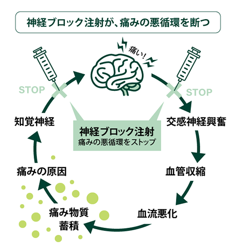 神経ブロック注射の体験談