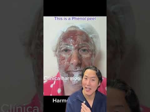 INCREDIBLE Chemical Peel Transformation! #shorts #chemicalpeel - YouTube