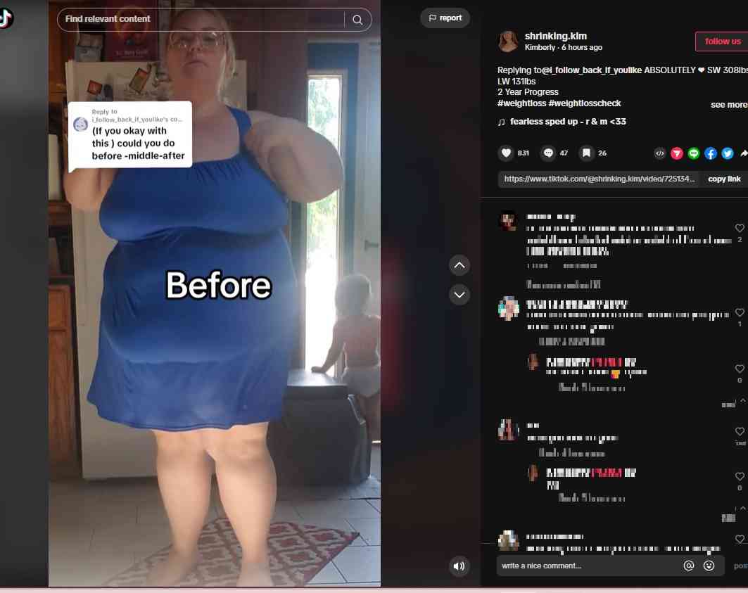 【海外発！Breaking News】2年で約80キロ痩せた女性、垂れた皮膚に「まるでムササビ！」の声（米）＜動画あり＞ | Techinsight（テックインサイト）|海外セレブ、国内エンタメのオンリーワンをお届けするニュースサイト