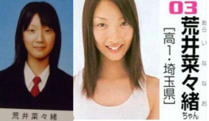 「整形前より醜くなった」と自信喪失…二重まぶたの手術を3回繰り返した女子大学生は身体醜形症になった