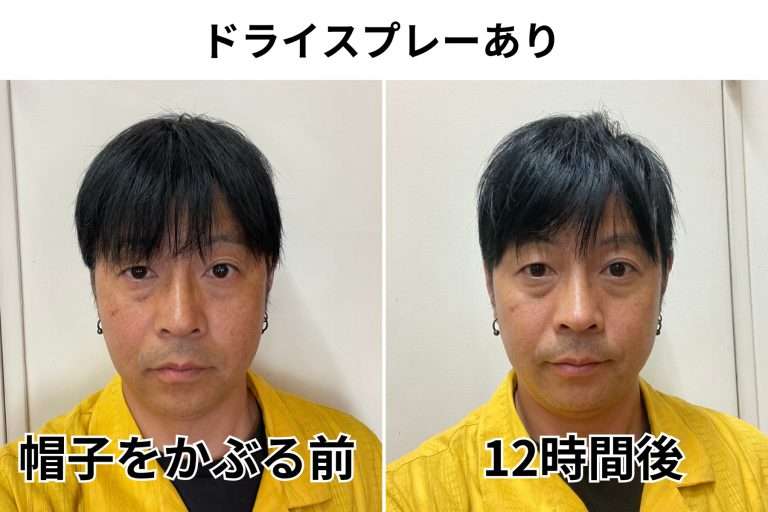 現役美容師が伝授「真夏に帽子を一日中かぶっても髪がペチャンコにならない」唯一の方法