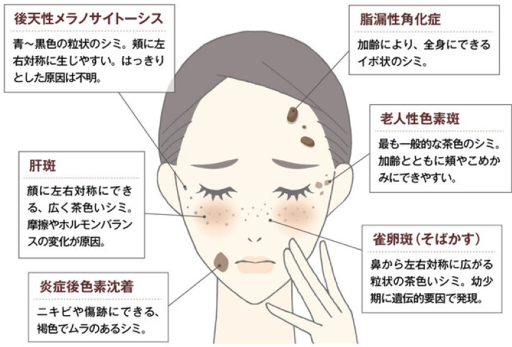 シミって市販の化粧品で薄くなりますか？