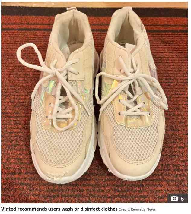 【海外発！Breaking News】フリマアプリで中古のスニーカーを格安で購入した女性、足がひどい発疹に見舞われる（英） | Techinsight（テックインサイト）|海外セレブ、国内エンタメのオンリーワンをお届けするニュースサイト