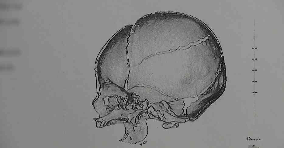 抱っこの手からすり抜けて落ちたわが娘　虐待疑われ7か月半も離れ離れに　児童相談所の「一時保護」なぜ裁判所は“違法”判決を下したのか