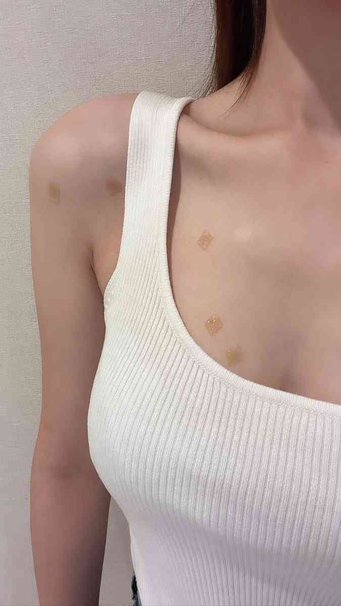 ダレノガレ明美 視聴者指摘の〝胸元の斑点〟を釈明「根性焼きではない」