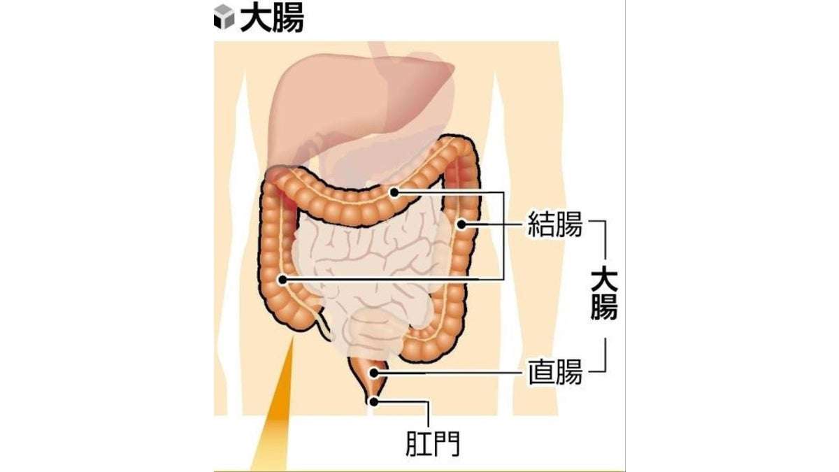 日本人に最も多い大腸がん、悪化させる体内物質を特定…京都大などの研究チーム : 読売新聞