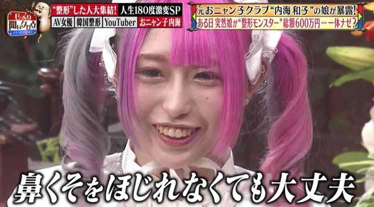 整形総額800万円アイドル、驚きの全財産を告白「まじでただの生活の危機」で仕事を急募