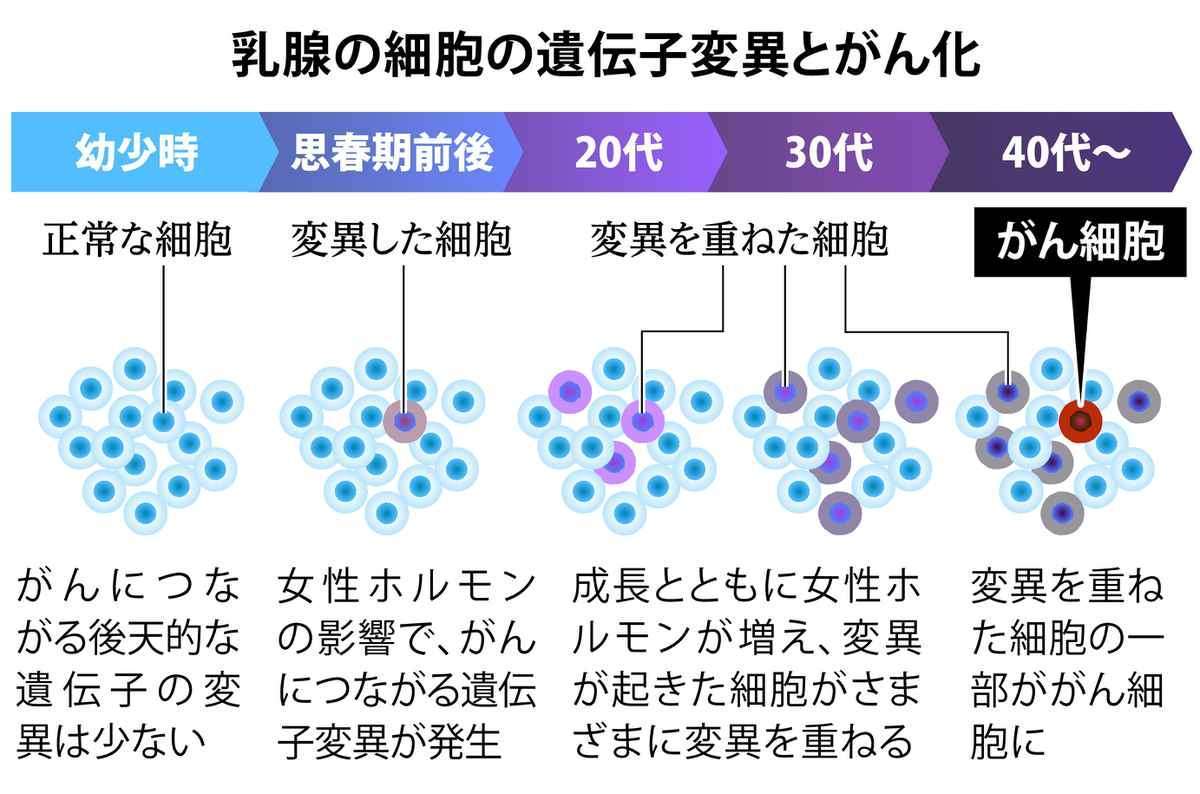 乳がんの原因、思春期の遺伝子変異だった　早期予防の可能性も　京大など世界初の発見