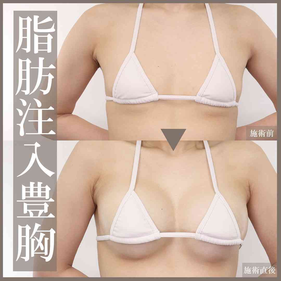 彼氏・旦那が美容整形に賛成派