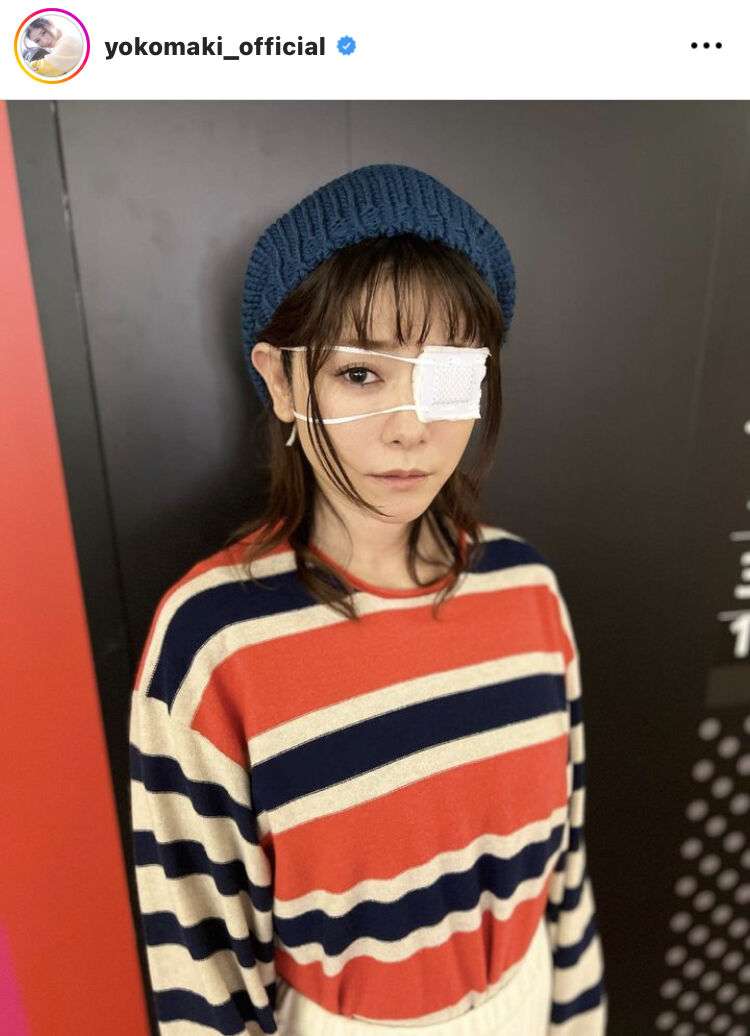 真木よう子 「1週間位前にやっちゃって」左目に眼帯をつけて「ぽかぽか」生出演