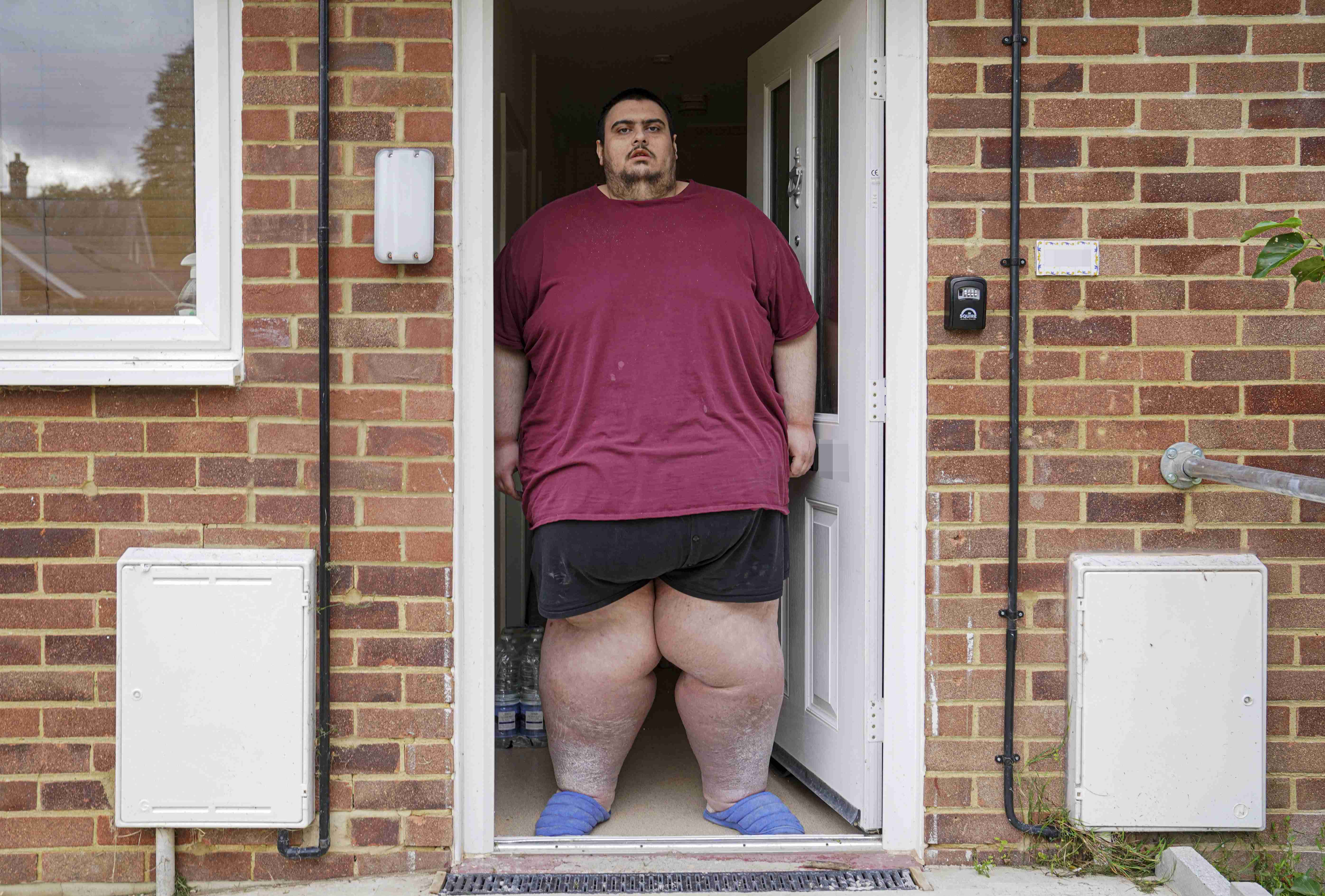 体重298キロ超の33歳男性 オムツを付け、立つこともできず母親が介護(英)