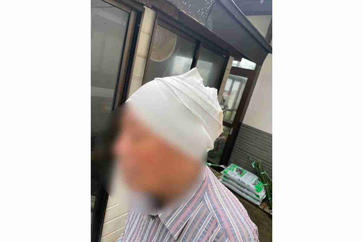 【秋田・クマ4人襲撃】「耳たぶが裂けてプランプラン」「指が頭に食い込んだ」被害者たちが語る「戦慄の瞬間」｜NEWSポストセブン