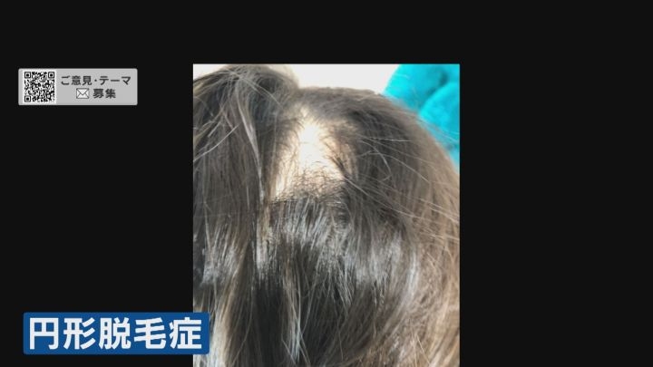 4歳娘「パンツに手入れられた…」幼い子供の間で起きる『性被害』の実態 被害者も加害者も性への認識なく