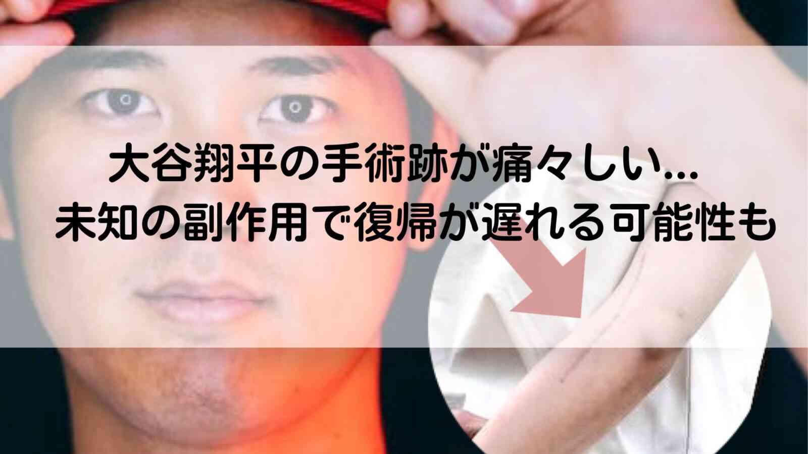 【画像】大谷翔平の手術跡が痛々しい！未知の副作用で復帰が長引く可能性も | きになLINK