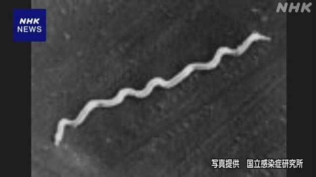 「先天梅毒」の子ども 過去最多に 10月4日時点で32人 | NHK | 医療・健康