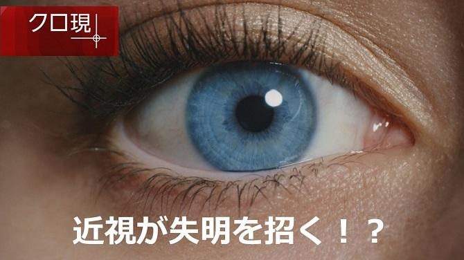 近視が失明を招く！？「日光」を利用した意外な予防方法とは？ | NHK健康チャンネル