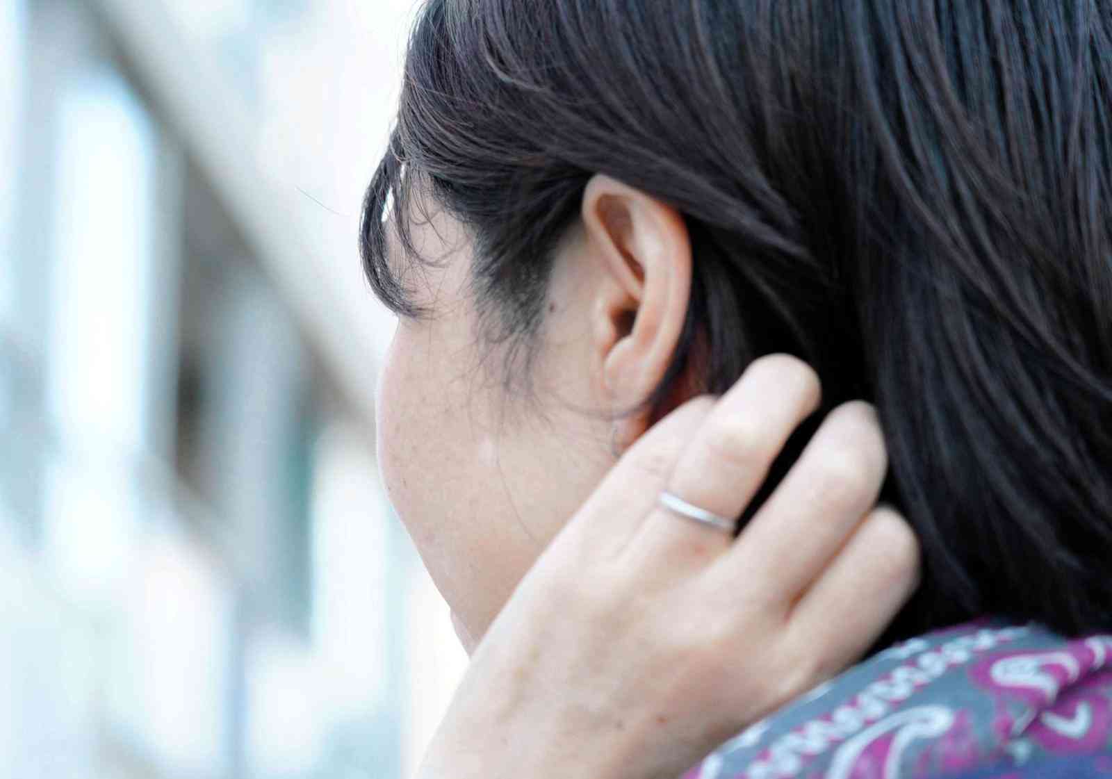 顔だけで100個近くのほくろに劣等感 探して、数えて、考えて…「醜いとしか思えなかった」