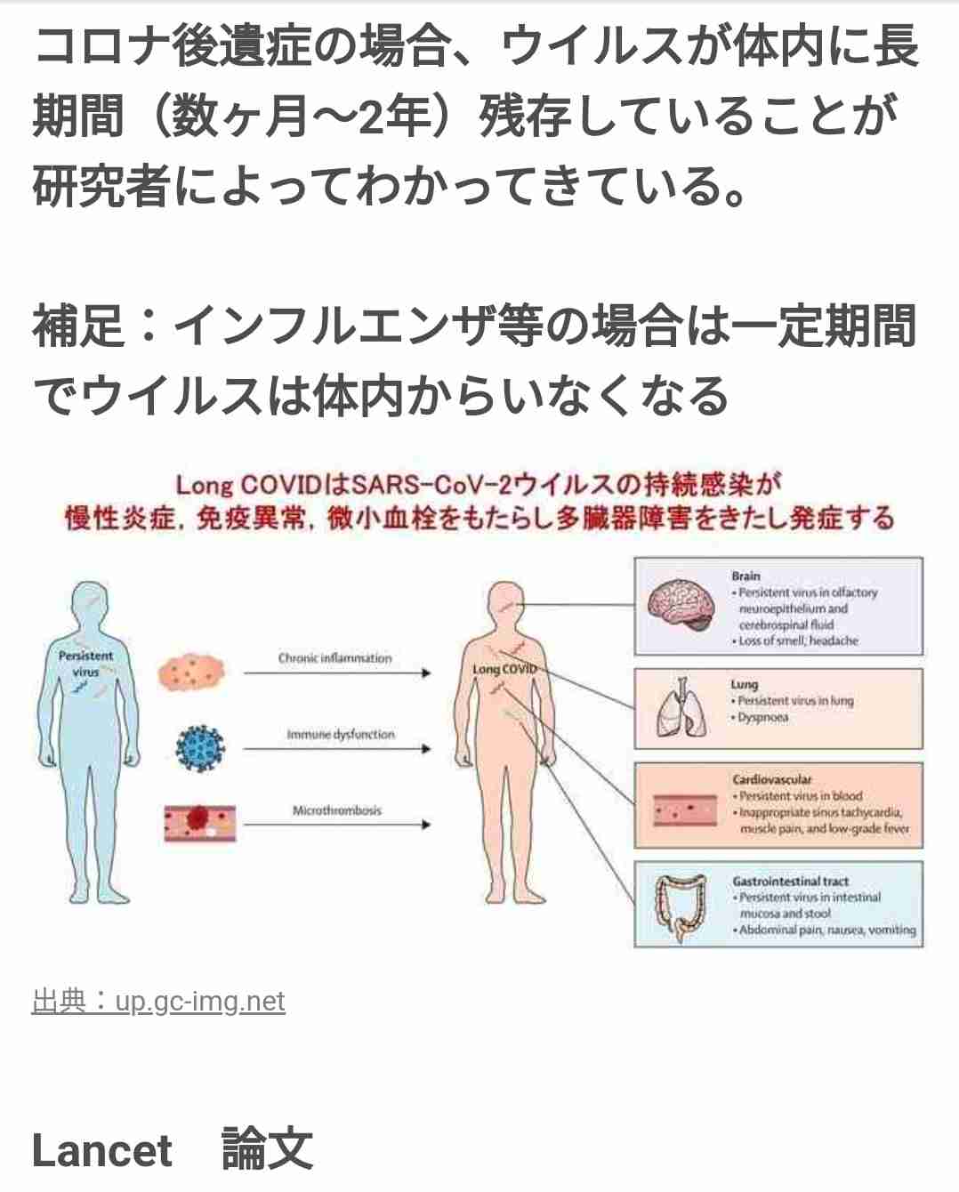 コロナ感染、心不全のリスク高まる可能性　理研など研究