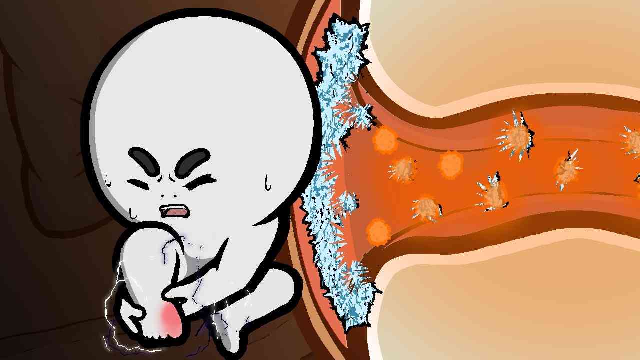 痛風になる仕組み - YouTube