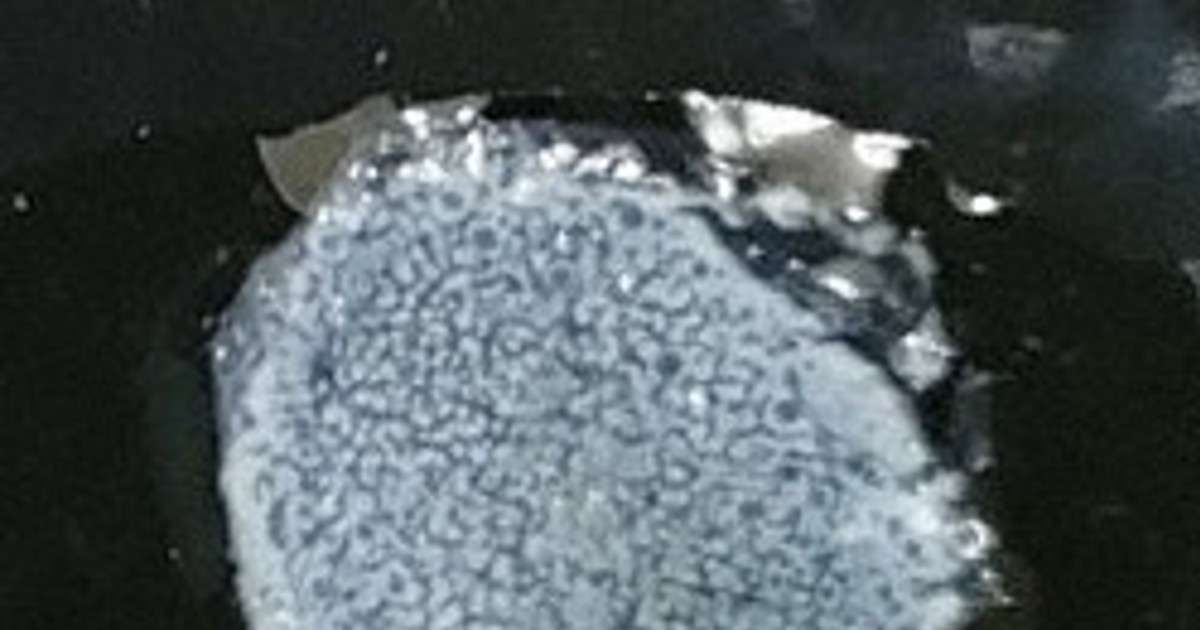コロナ感染、心不全のリスク高まる可能性　理研など研究