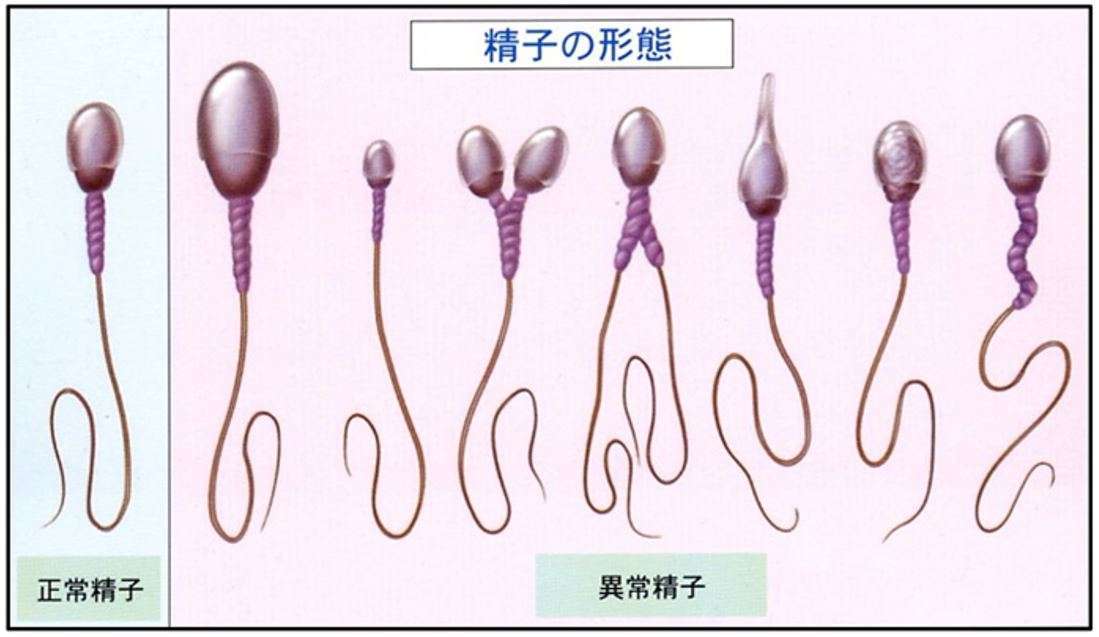 20代未婚男性の46％が交際経験なし、過去最高 女性も同様の傾向