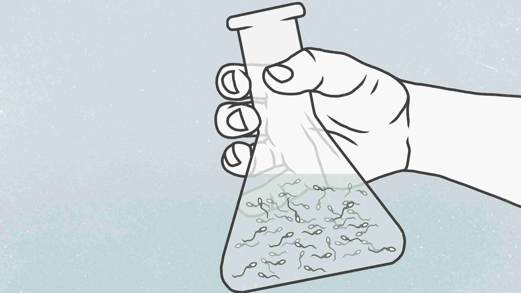 実は怖い「精子の高齢化」…早産や先天性疾患で母胎や胎児を危険にさらす可能性も