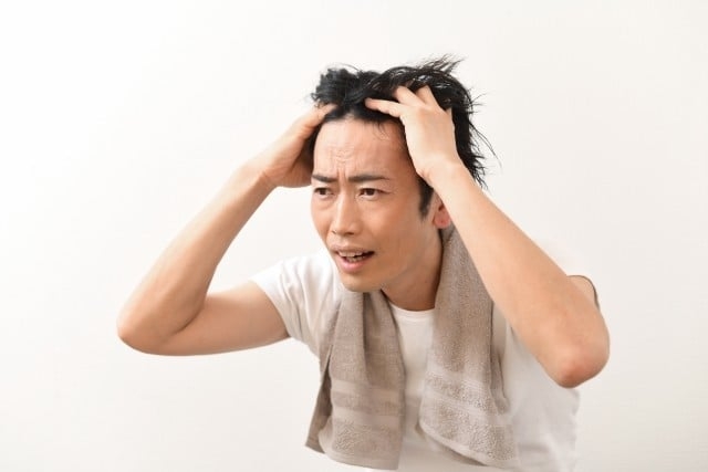男性のハゲの原因は何ですか?