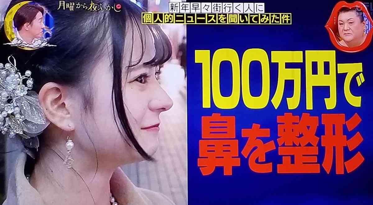 生後6カ月の娘の容姿に悩んだ母 夫の前で感情爆発「整形させるから」