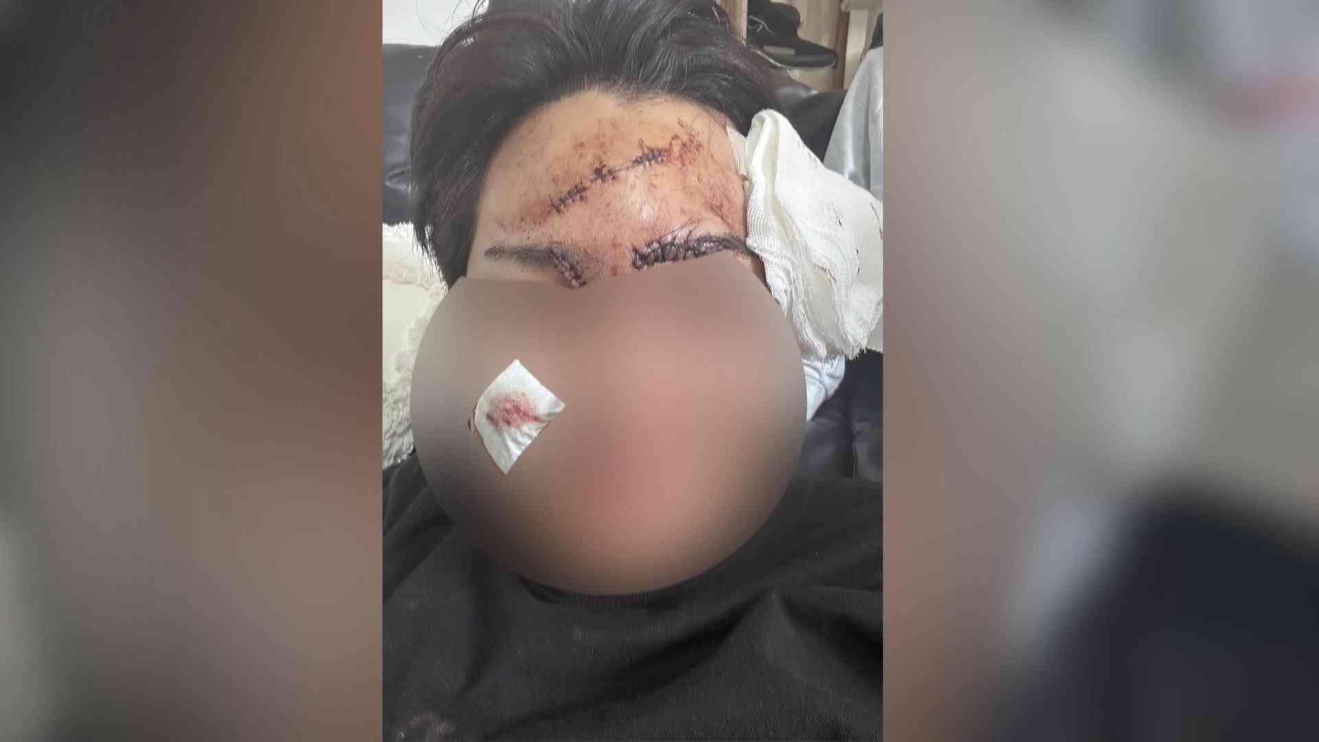 【独自】榊原容疑者に酒瓶で殴られ20針…被害者告白　元交際相手も語る“凶暴性”「親もペットも全部殺す」・ピアノ教師殺害（FNNプライムオンライン） - Yahoo!ニュース