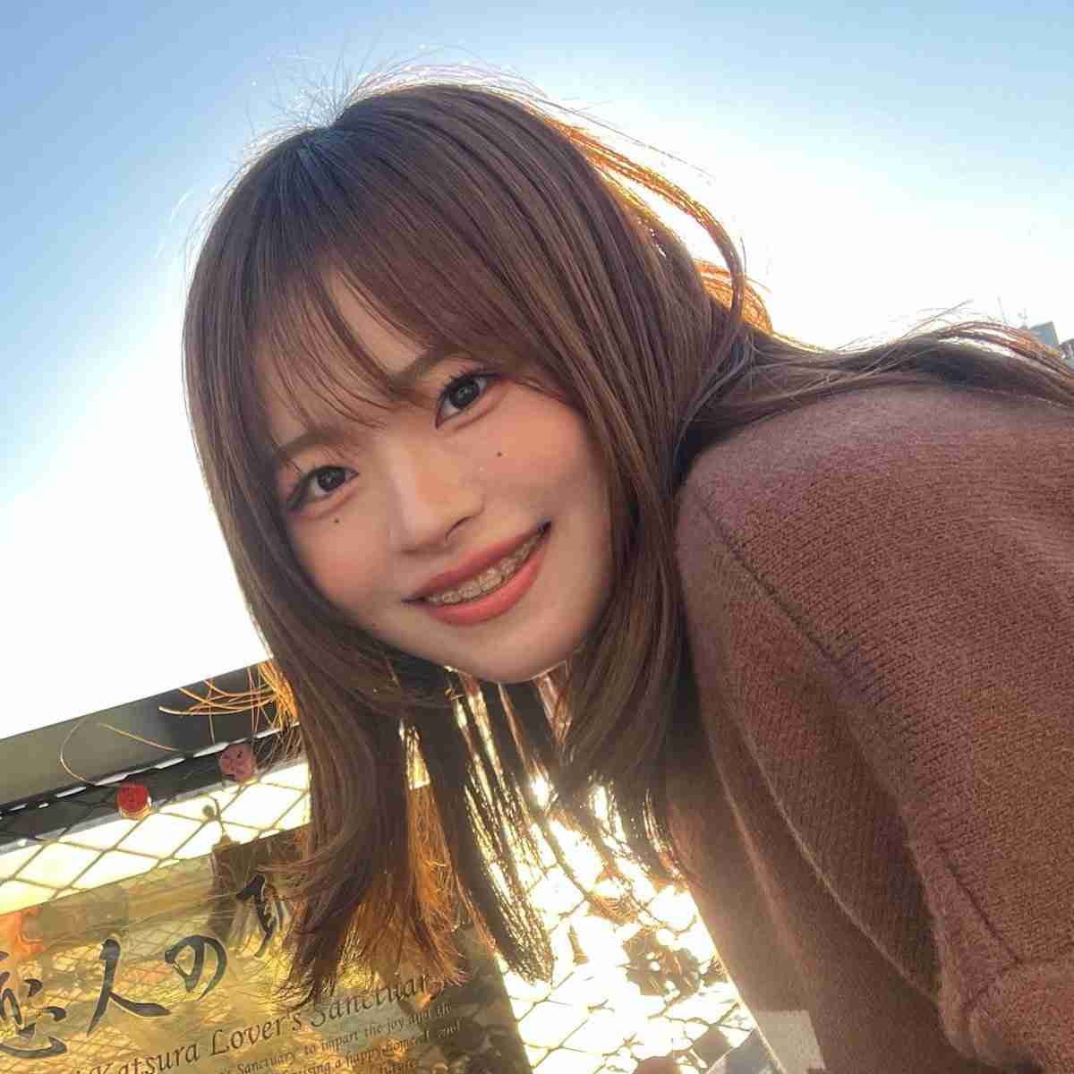 「こんなに変わるの!?」「めっちゃ綺麗！」　人気YouTuber、3年間の“歯列矯正ビフォーアフター”で垢抜け美女に大変身