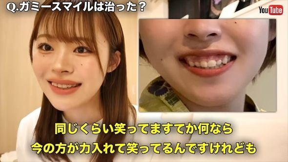 「こんなに変わるの!?」「めっちゃ綺麗！」　人気YouTuber、3年間の“歯列矯正ビフォーアフター”で垢抜け美女に大変身