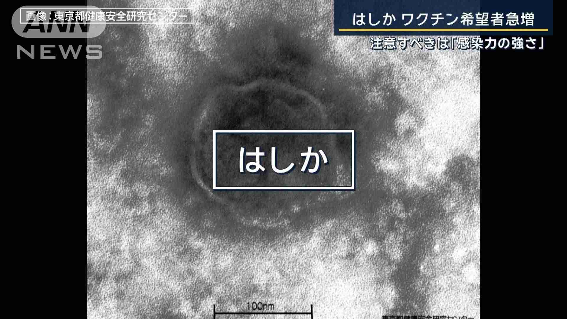 「重症化すると肺炎や脳炎に」接触だけでなく空気感染も“はしか”ワクチン希望者急増