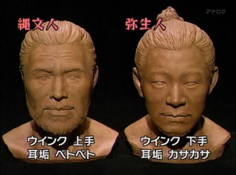 耳垢カサカサ派?しっとり派?