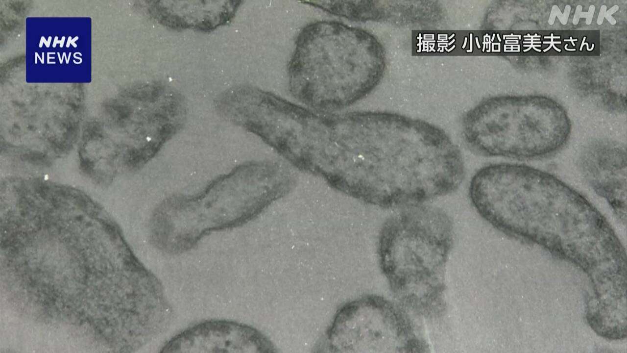 はしかの症状軽視も… ワクチン予防否定するSNSの誤情報に注意 | NHK | フェイク対策