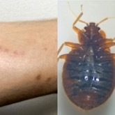 〈日本にもついにトコジラミ⁉〉都内の電車での目撃情報が拡散されパニック…「水際対策はできない」「すでに一般家庭にも侵入」「これからますます繁殖」と専門家…JRにも直撃（集英社オンライン） - Yahoo!ニュース