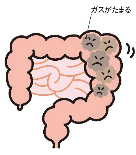 お腹のガスを抜く方法