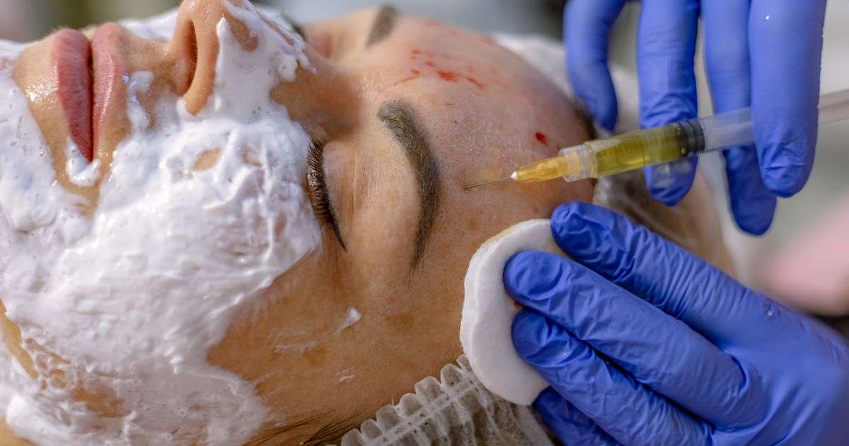 美容クリニックでのヴァンパイアフェイシャルで女性3人がHIV感染、アメリカで衝撃走る | ハフポスト NEWS