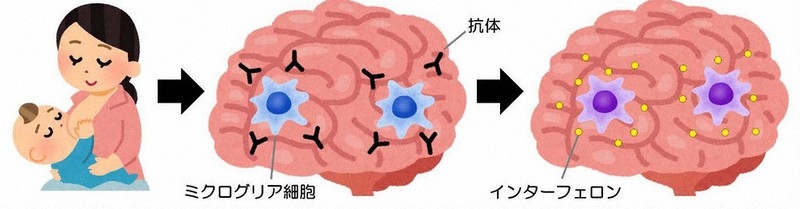 母乳の抗体が子どもの脳に影響 メカニズム解明 親子で研究チーム