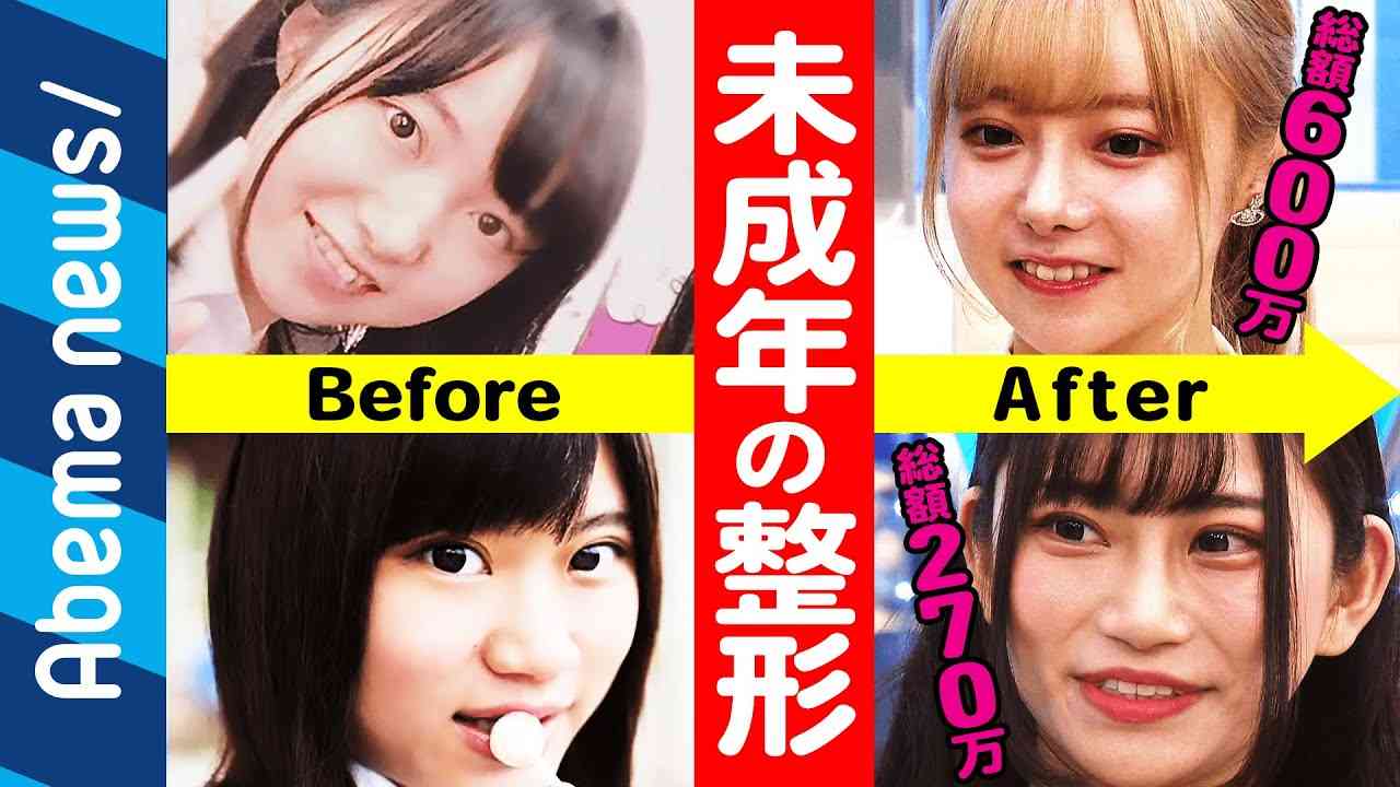 【未成年の整形】17歳から整形！総額600万、270万…お金は？周りの反応は？本人に直撃【望月める】【小鳥遊まゆう】【井上真梨子】｜#アベプラ《アベマTVで放送中》 - YouTube