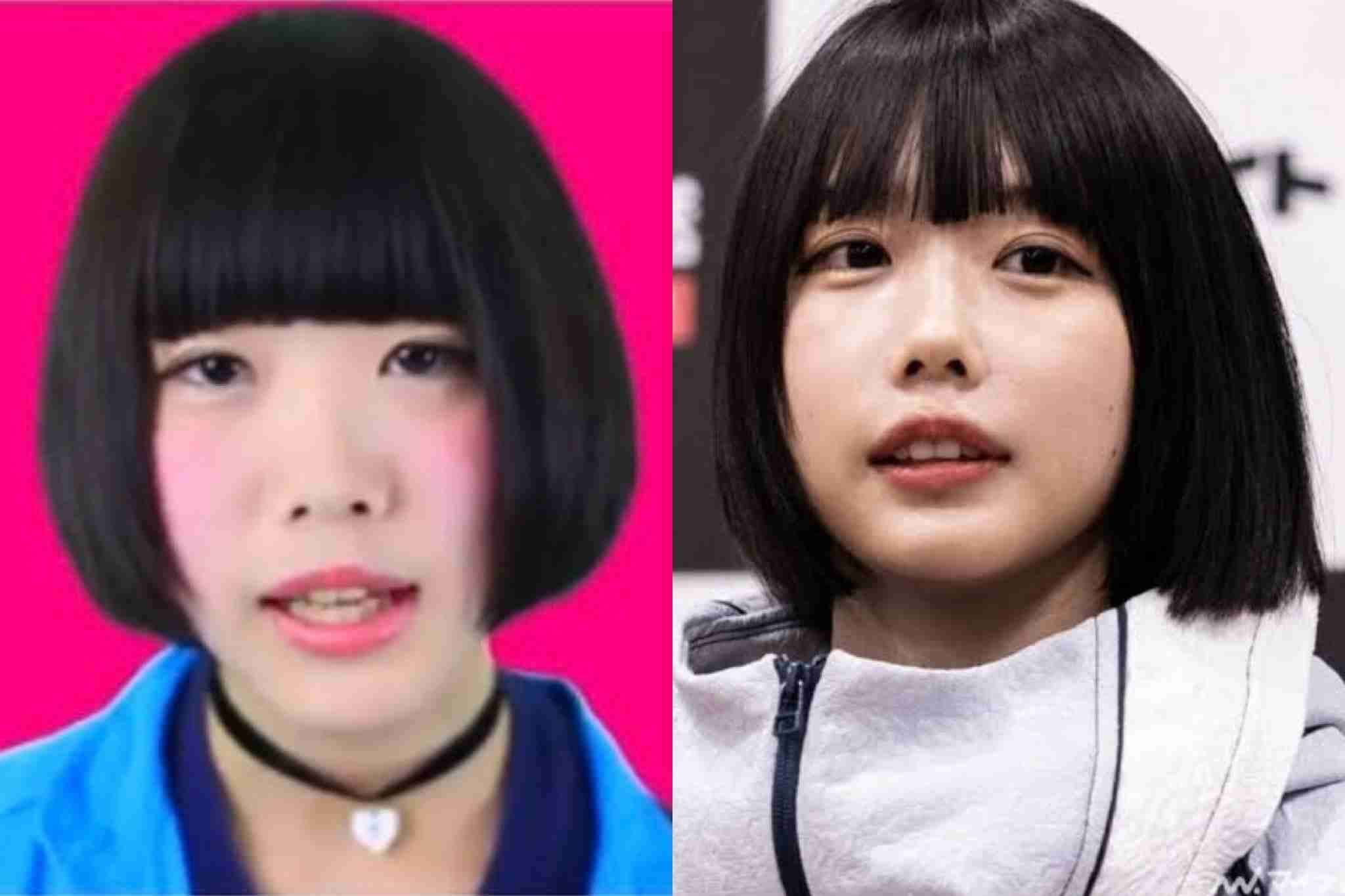 整形したがる娘にキレそうです