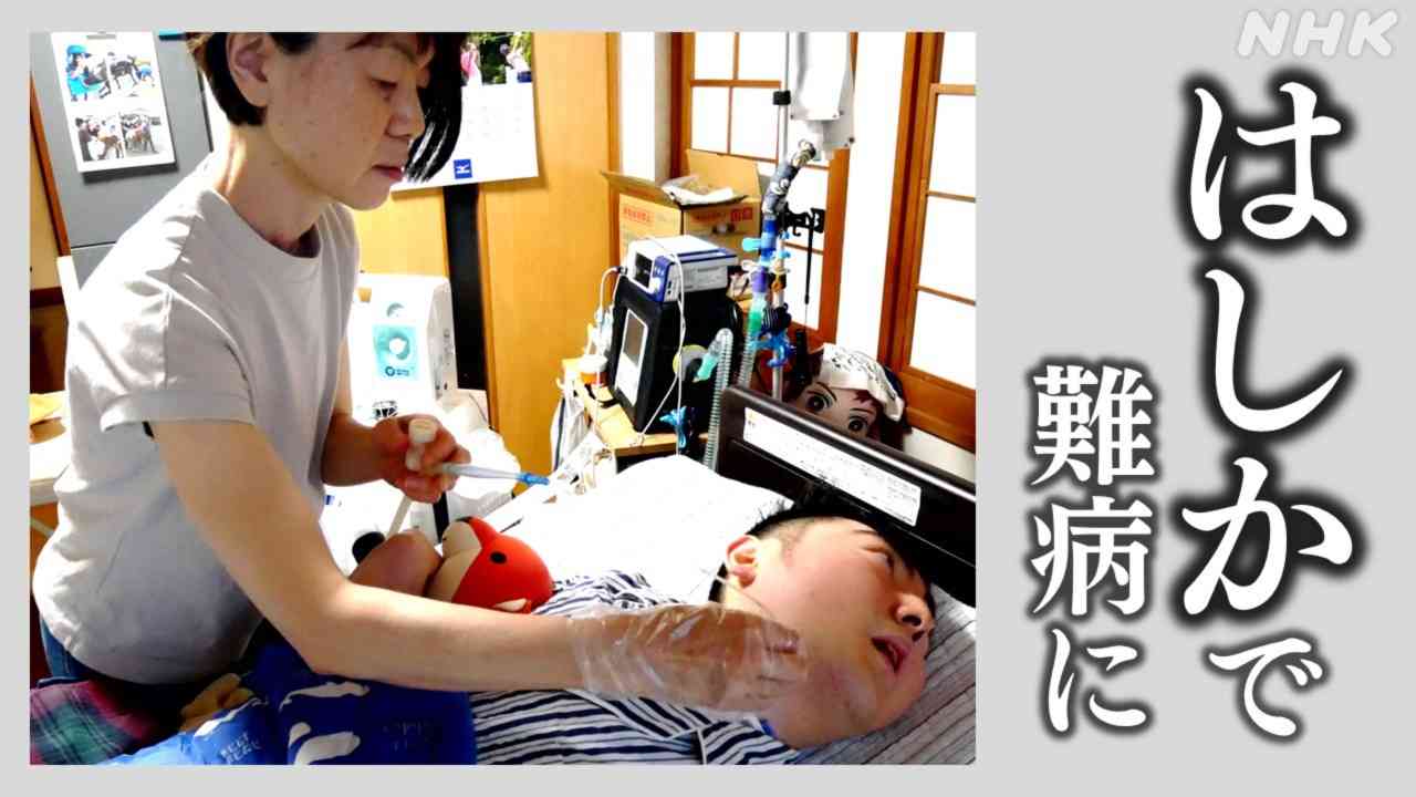 はしか（麻疹）で亜急性硬化性全脳炎（SSPE）に 寝たきりになることも | NHK