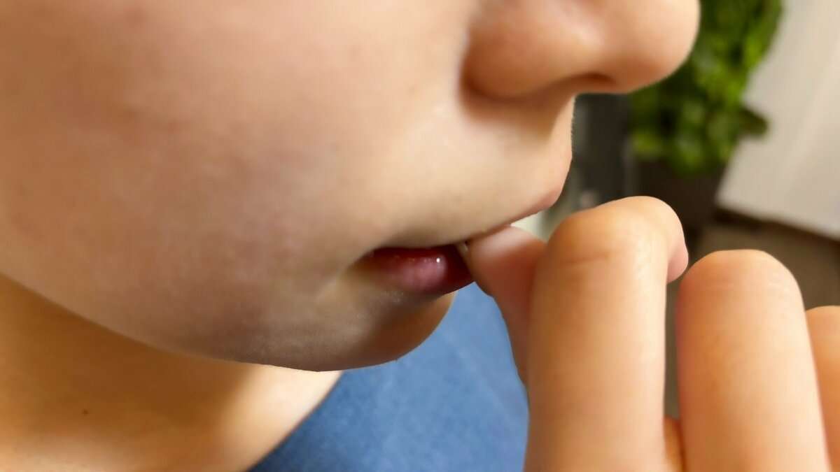 「爪噛み症」なぜ噛んでしまうのか？…皮膚科医・小児科医と考える　身体への影響は？対処法は？「爪噛みは親の愛情不足」は迷信 | TBS NEWS DIG