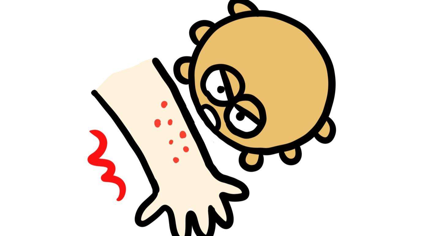 首都圏やネットを騒がせたトコジラミは自宅にいる？放置すると最短で30日、数十万円の駆除費用がかかる！（栗栖成之） - エキスパート - Yahoo!ニュース