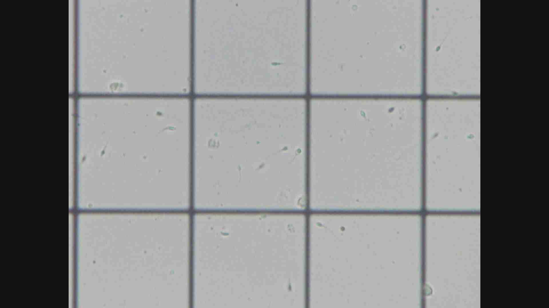 精子が寿命を迎える年齢とは ～精子“老化”の新事実～ - NHK クローズアップ現代 全記録