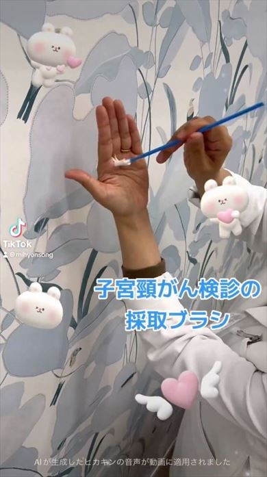 子宮頸がん検診に使うブラシは“凶器”? 産婦人科医が真っ向否定&「どうして痛い人がいるのか」の解説が合計930万表示