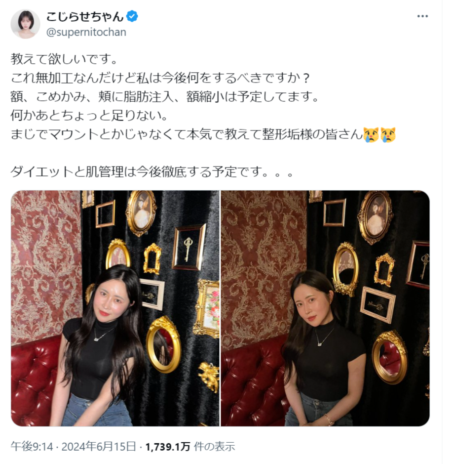 いくら整形しても「顔がデカい」と言われ…整形アカウント“炎上”の真相を本人に聞いた